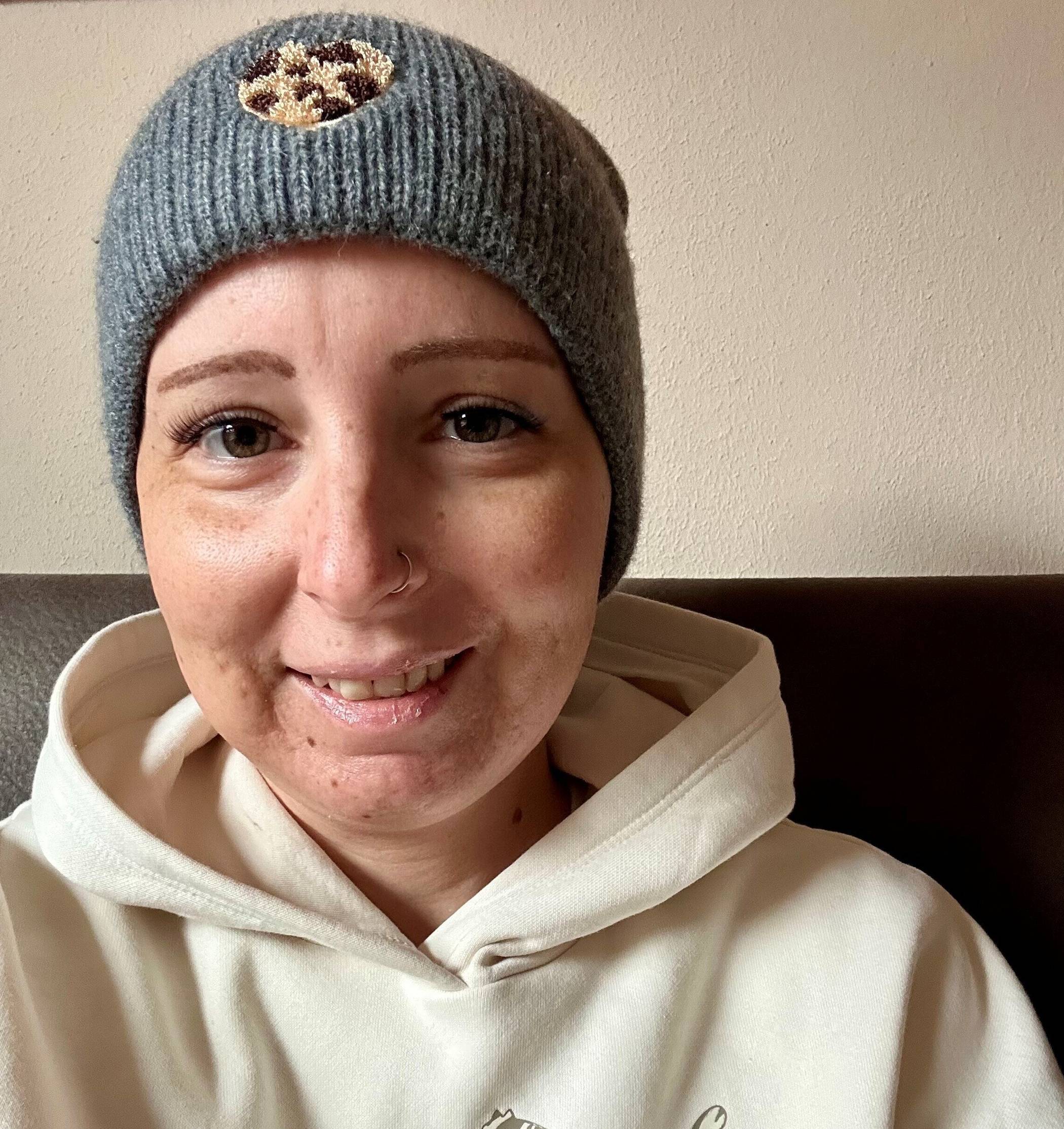  Yvonne hat ihrer Diagnose den Kampf angesagt.  